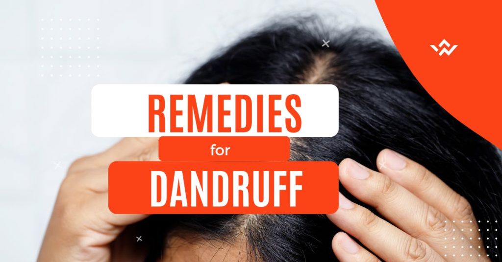 dandruff treatment at home